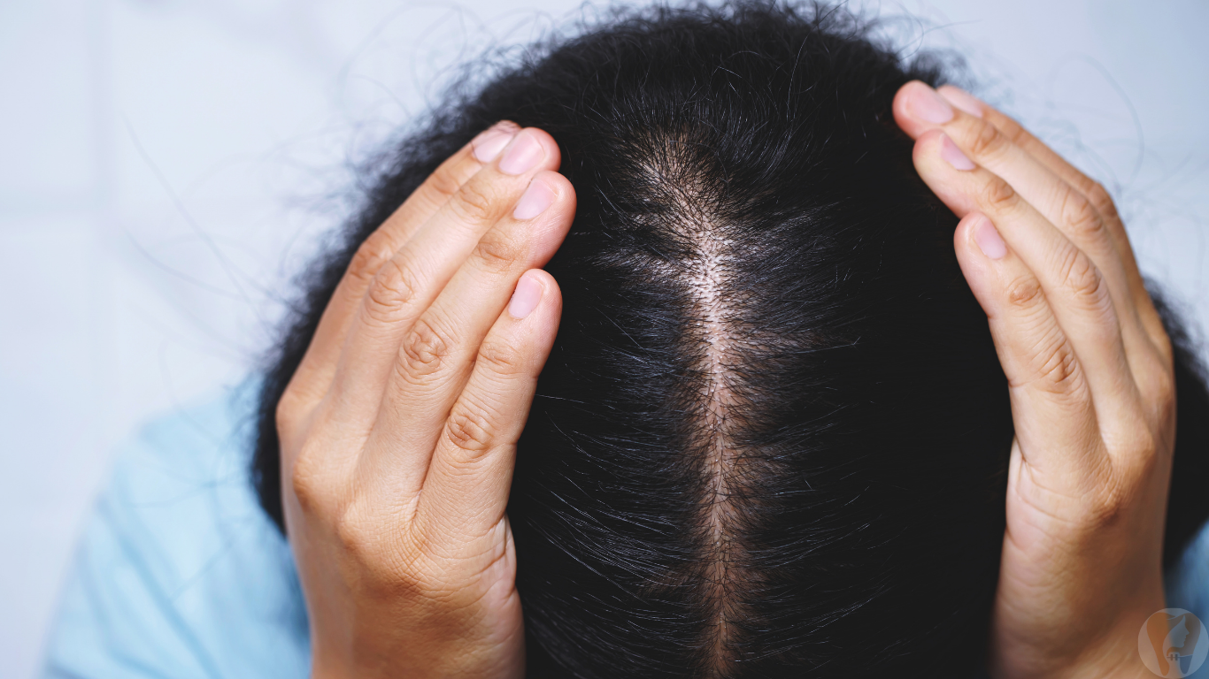 Hair & Scalp Disorders Treatment at Janagond Skin & Dental Clinic, Vijayapura