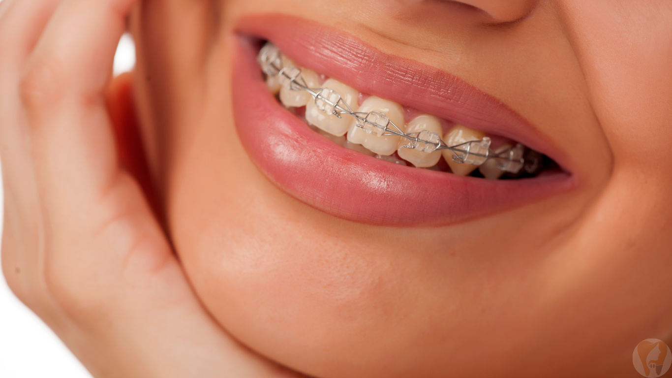 Orthodontic Treatments Janagond Skin & Dental Clinic , Vijayapura